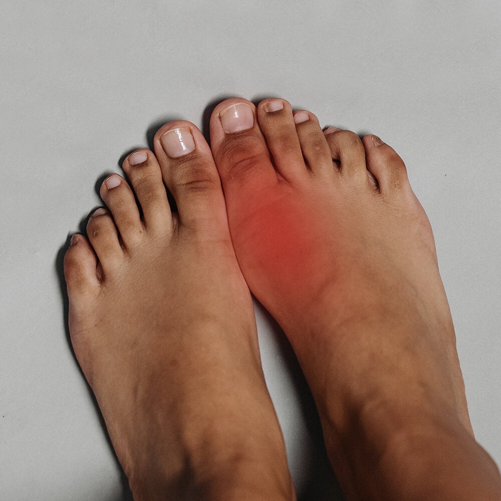 https://www.myfeet.no/pub_docs/files/Guidefotproblem/gikt-inflammation-i-stortaled.jpg